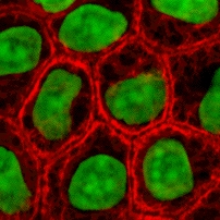 Komórki nabłonka pod mikroskopem fluorescencyjnym